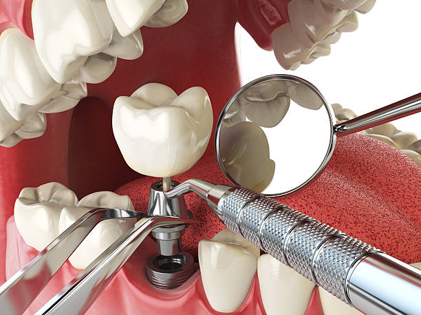 Best Emergency Dentist for Lost Fillings or Crowns in Three Rivers, TX